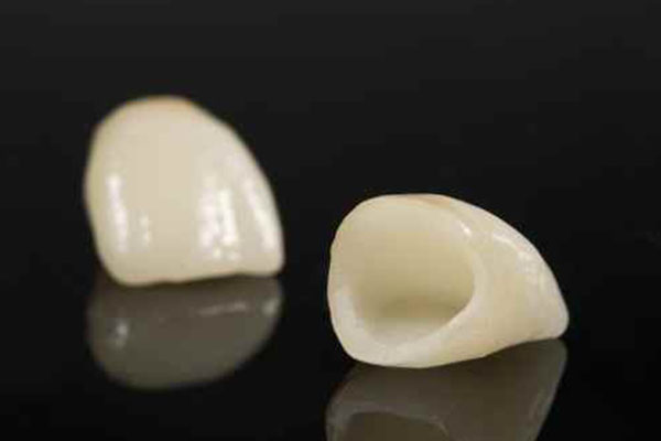 bdr prothese nos produits prothese fixe couronne ceramo-ceramique