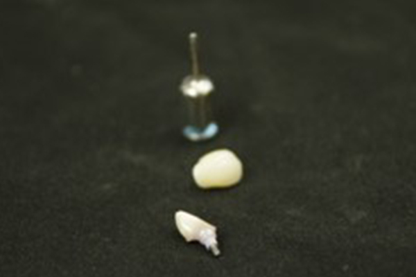 bdr prothese nos produits implantologie pilier implantaire sur mesure 2